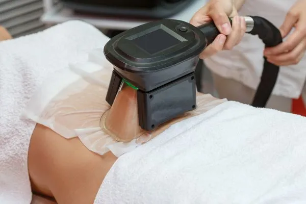 Image of person having fat freezing treatment to help weight gain Moseley