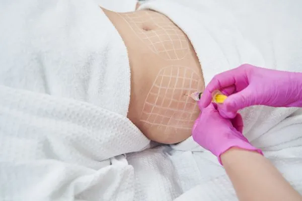 image of fat dissolving injections on love handles to help combat weight gain Moseley