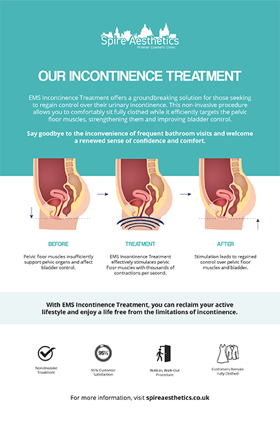 image to show how EMS treatment works for female urinary incontinence Moseley