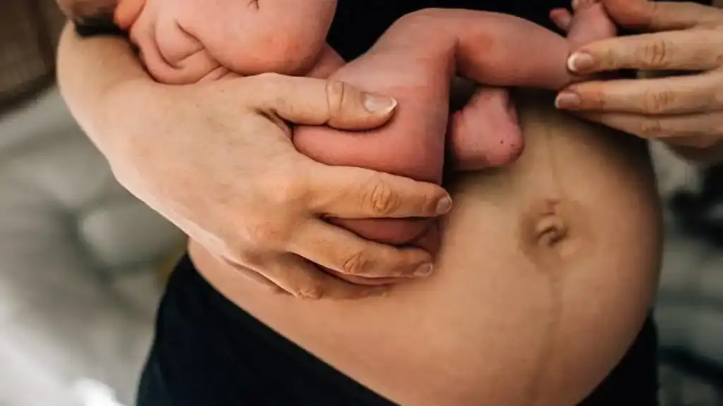 Why Is My Stomach Still Big After Pregnancy Moseley?